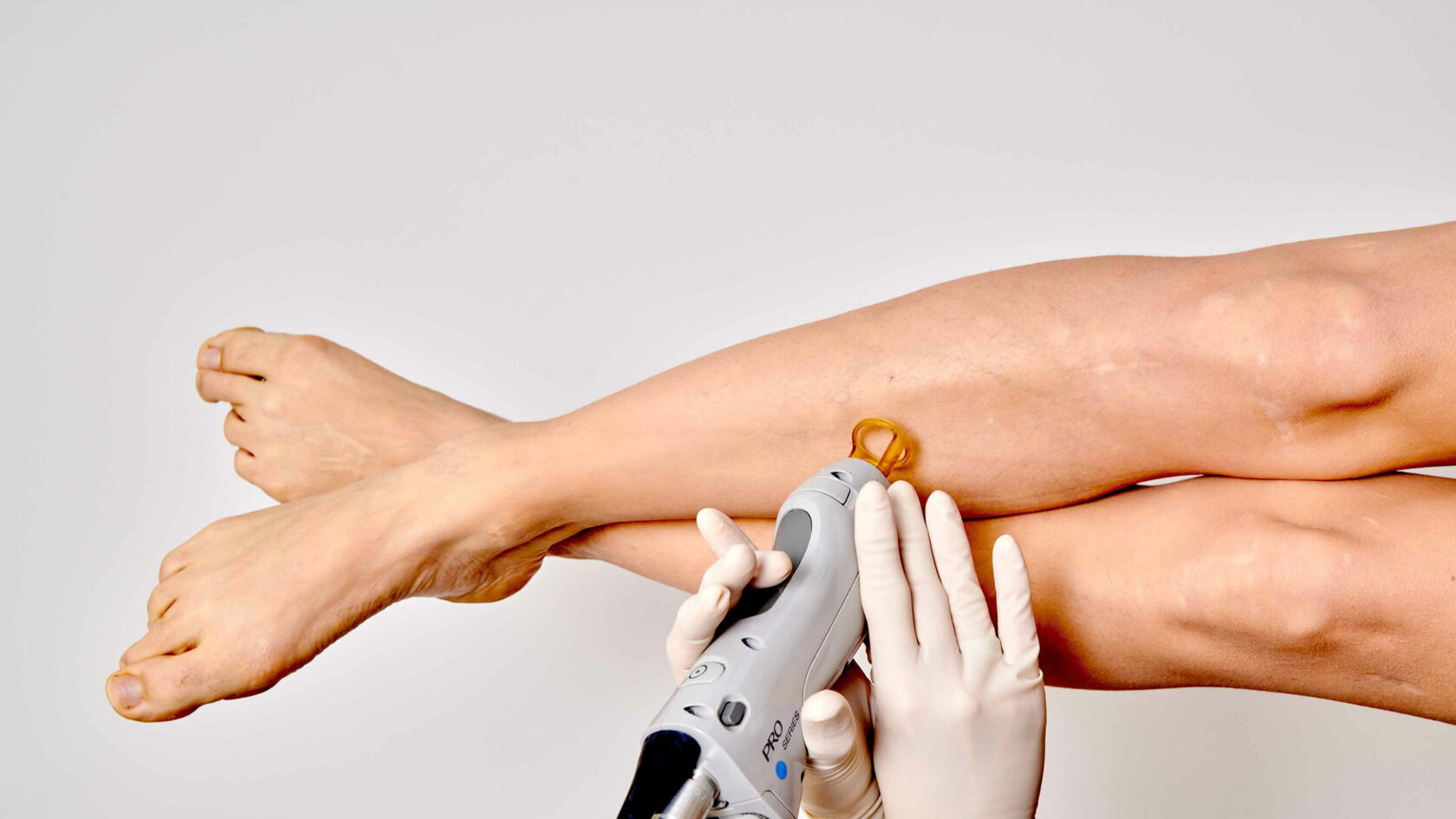 Épilation au Laser | Demi-Jambe main image 1